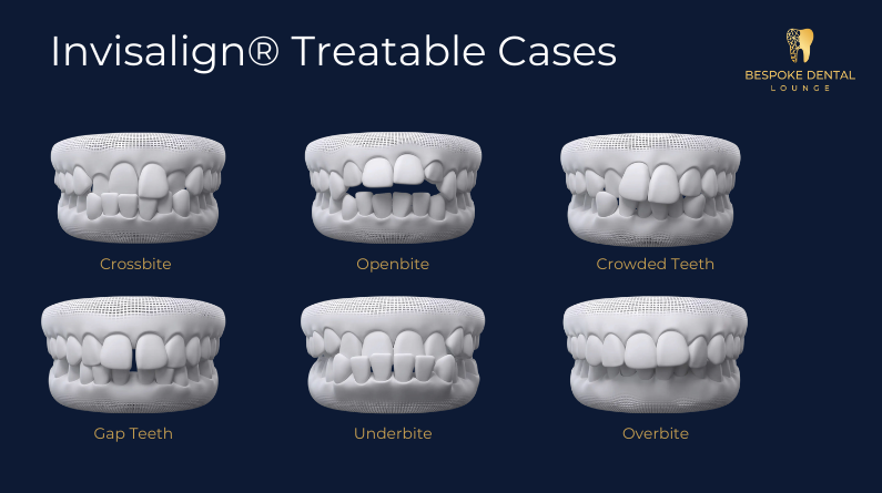 Illustrations to showcase the types of cases Invisalign can treat